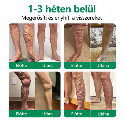 🌿CleraNaure® VeinTarget Mikrotűs Pólya 🗽 Azonnali Enyhülés, Hosszú Távú Eredmények🌿🌿