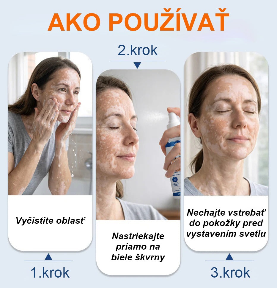 🌿Laleia® Piperín Repigmentačný aktivačný sprej
