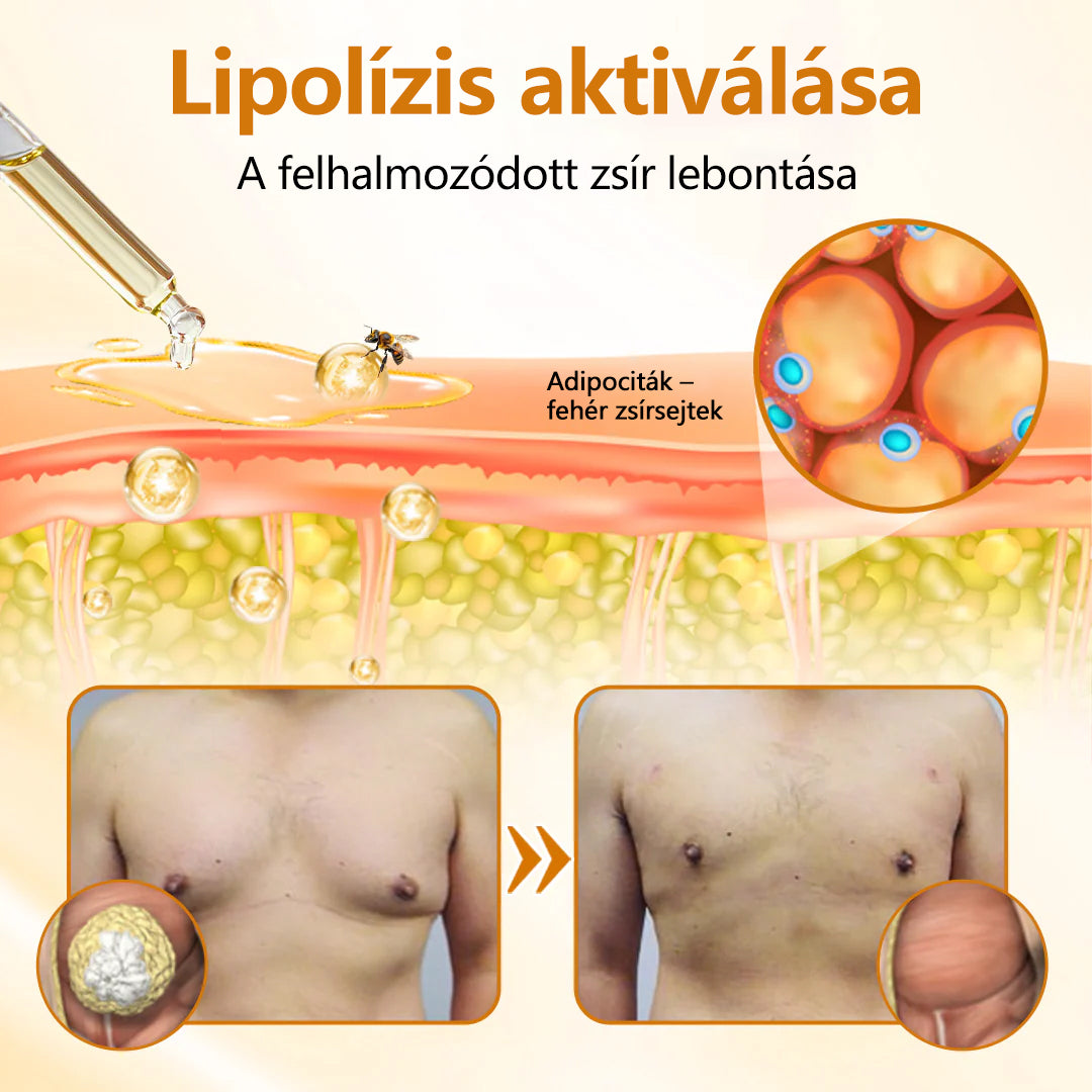 🔥 FÉRFI MELLFORMÁZÓ FRISSÍTÉS💪 CleraNaure® VenomDefine Pro Mellformázó Olaj 🐝 Napi Méhméreg Támogatás a Feszesebb, Jobban Formázott Mellért🐝