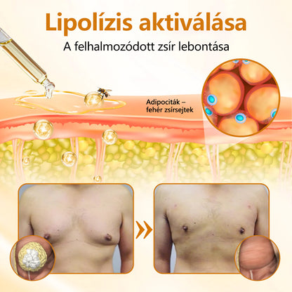 🔥 FÉRFI MELLFORMÁZÓ FRISSÍTÉS💪 CleraNaure® VenomDefine Pro Mellformázó Olaj 🐝 Napi Méhméreg Támogatás a Feszesebb, Jobban Formázott Mellért🐝