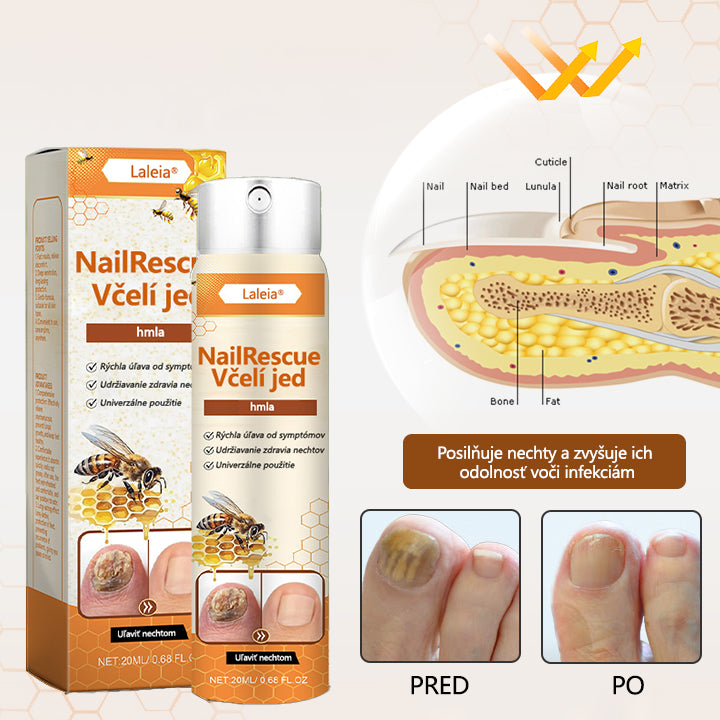 ⭐⭐Laleia® NailRescue sprej s včelím jedom
