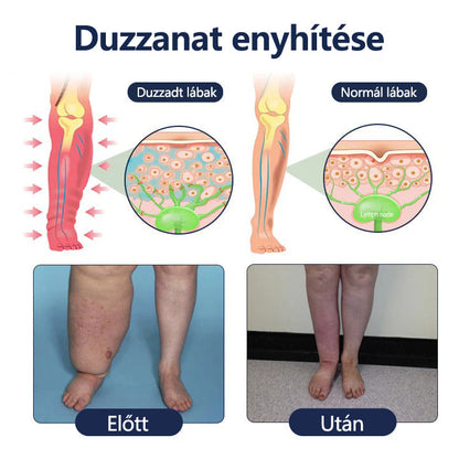Buzora® keringést támogató krém duzzadt, nehéz lábakra
