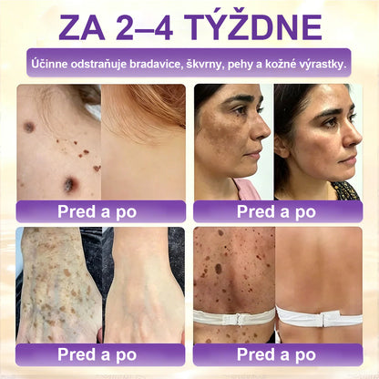 Laleia® Biotin 10 v 1 kožný regeneračný krém✨
