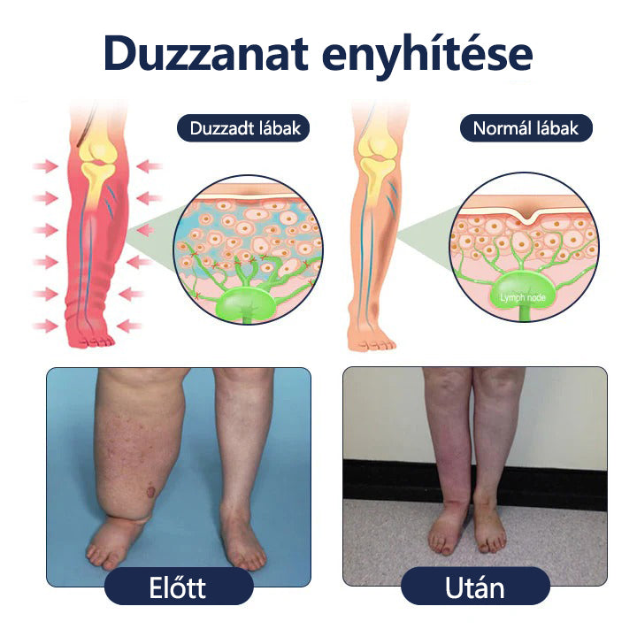 Buzora® keringést támogató krém duzzadt, nehéz lábakra🎁