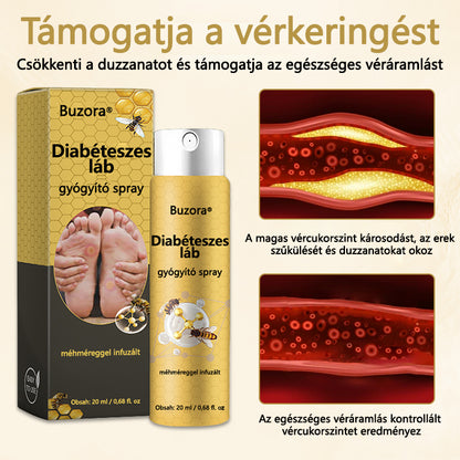 🌿Buzora® Diabéteszes láb gyógyító spray - Méhméreg infúzióval