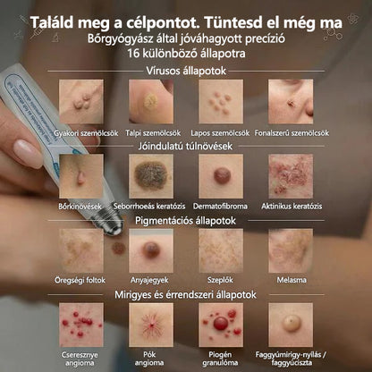 Hivatalos áruház🎉CleraNaure® 7 napos pigmentfolt- és bőrhiba-eltüntető kezelés (Fájdalommentes, hegmentes görgős applikátor)