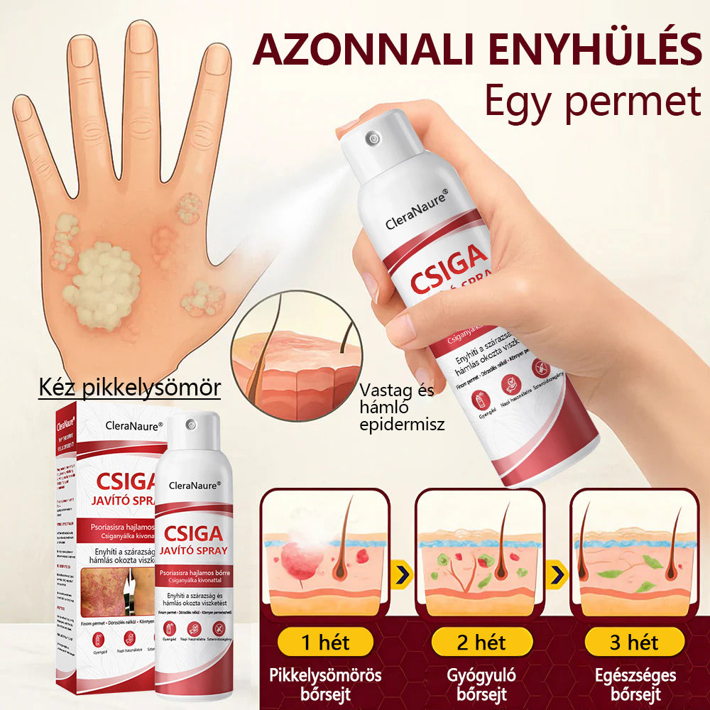 CleraNature® Bálnazsír Spray Viszkető, Hámló Psoriasisra Hajlamos Bőrre⭐⭐⭐