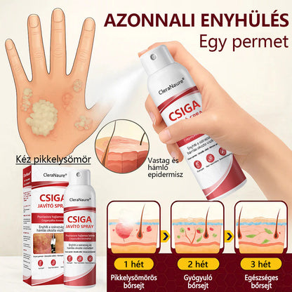 CleraNature® Bálnazsír Spray Viszkető, Hámló Psoriasisra Hajlamos Bőrre⭐⭐⭐