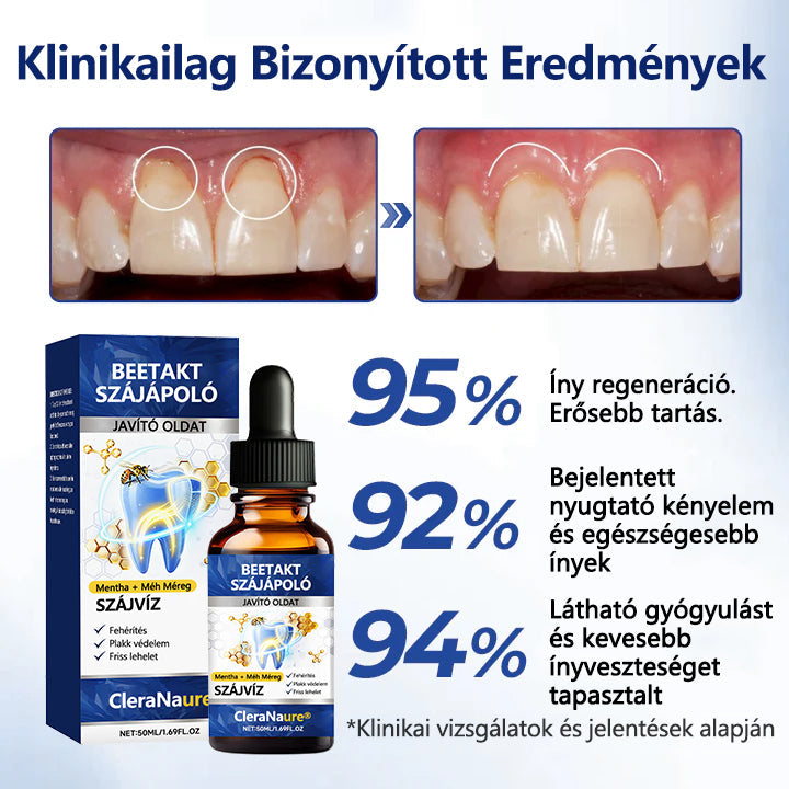 💎CleraNaure® BeeTakt Szájápoló Javító Oldat ✨💙