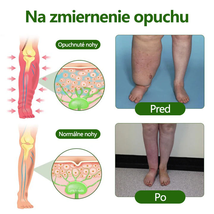 🔥Laleia® profesionálny krém na starostlivosť o nohy