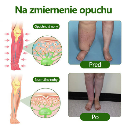 🔥Laleia® profesionálny krém na starostlivosť o nohy