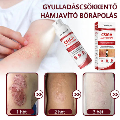 CleraNature® Bálnazsír Spray Viszkető, Hámló Psoriasisra Hajlamos Bőrre⭐⭐⭐