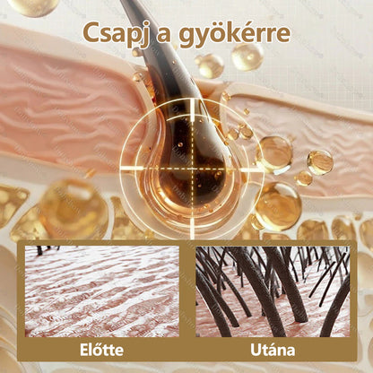 🔥 Hajnövesztő kapszula | CleraNaure® hajnövesztő kapszula | Nanotechnológiás behatolás, mélyen a hajgyökerekig