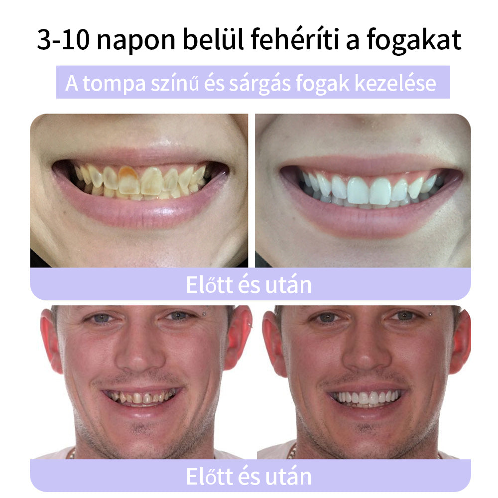 🦷🦷CleraNature® Fogak Helyreállító Ásványi Por🦷🦷