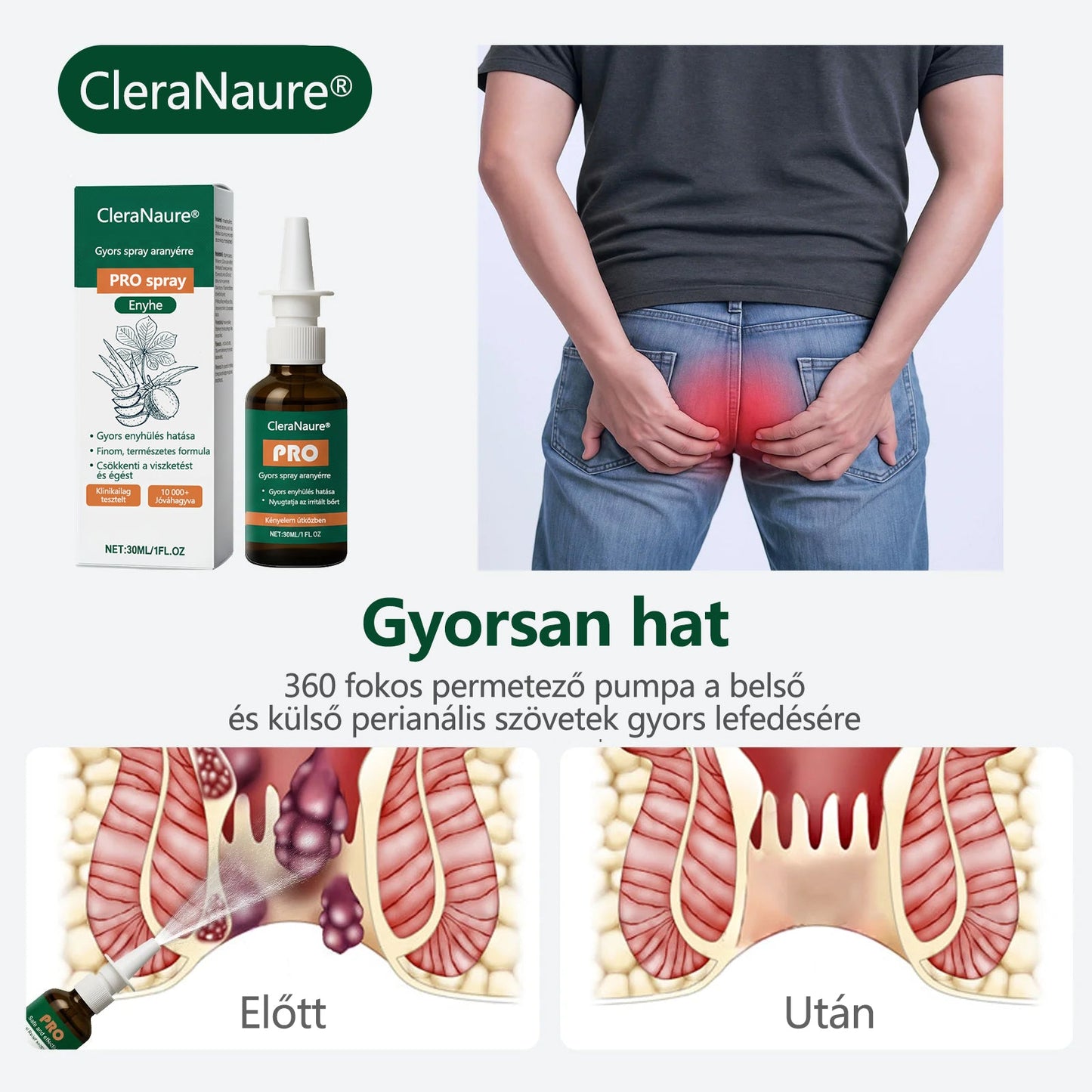 🎁 Időszakos ajánlat | CleraNaure® Gyors Aranyér PRO Spray🎁