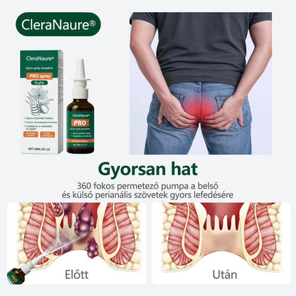 🎁 Időszakos ajánlat | CleraNaure® Gyors Aranyér PRO Spray🎁