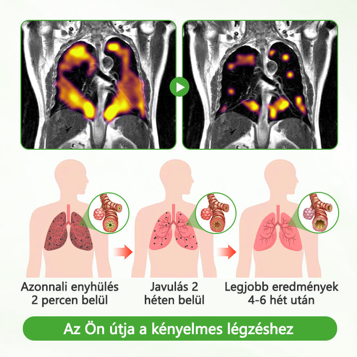 🏅CleraNaure® HerbaAir Mullein Tüdőtisztító