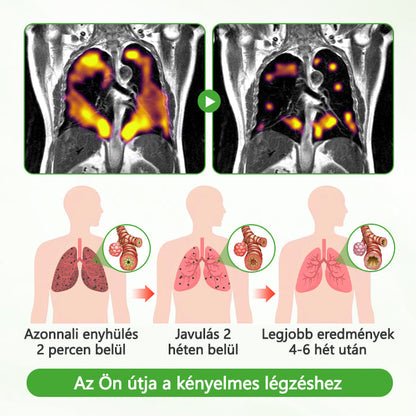 🏅CleraNaure® HerbaAir Mullein Tüdőtisztító