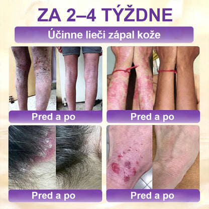Laleia® Biotin 10 v 1 kožný regeneračný krém✨