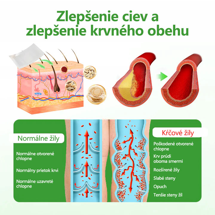 🔥Laleia® VeinHeal náplasť s mikroihličkami