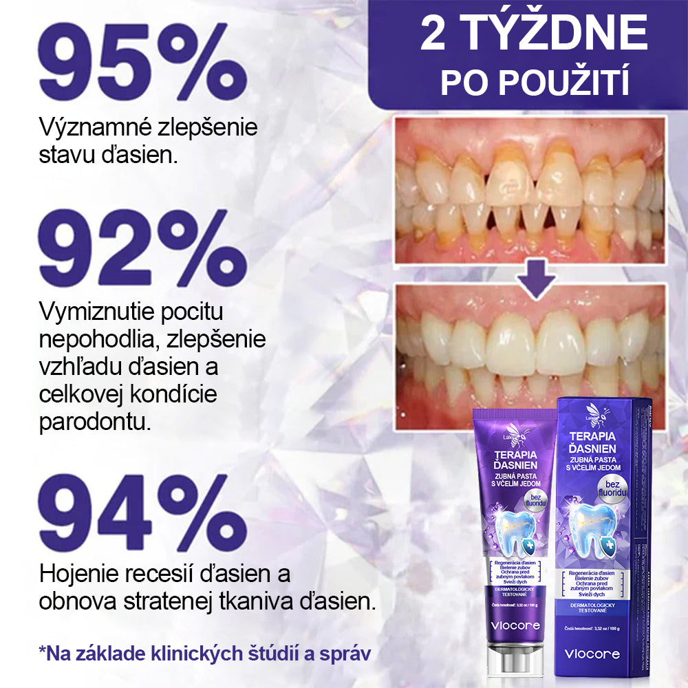 🔥Laleia® VioCore Zubná pasta s včelím jedom na ošetrenie zubov