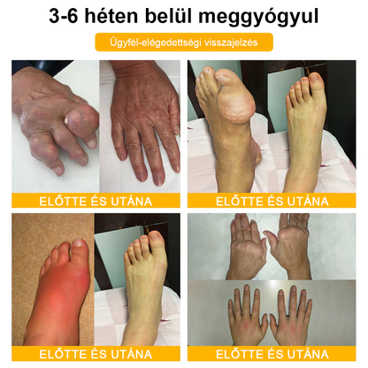 Buzora® Botulinum Toxin és Méhméreg Fájdalomcsillapító Csontgyógyító Krém🌿