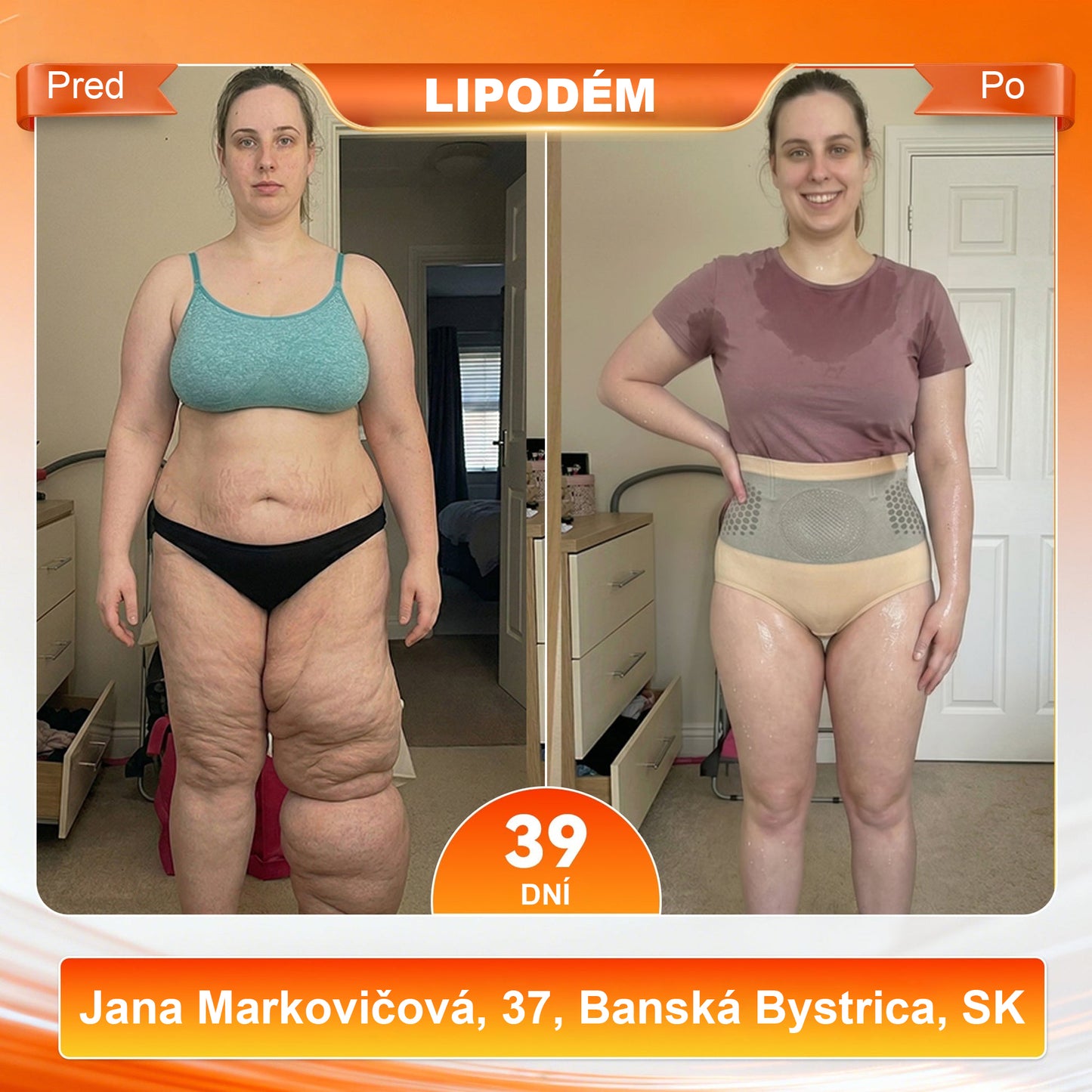 🛡️ Laleia® 2026 Moringa a Berberín 4 v 1 Mikročasticové tvarovacie a spaľovače tuku šortky