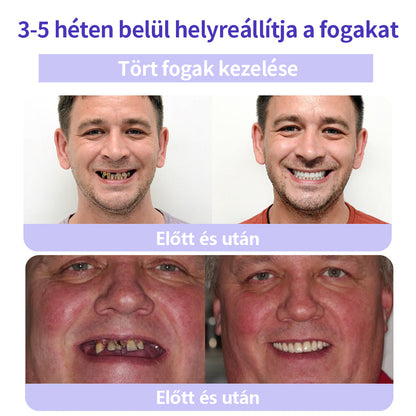 🦷🦷CleraNature® Fogak Helyreállító Ásványi Por🦷🦷