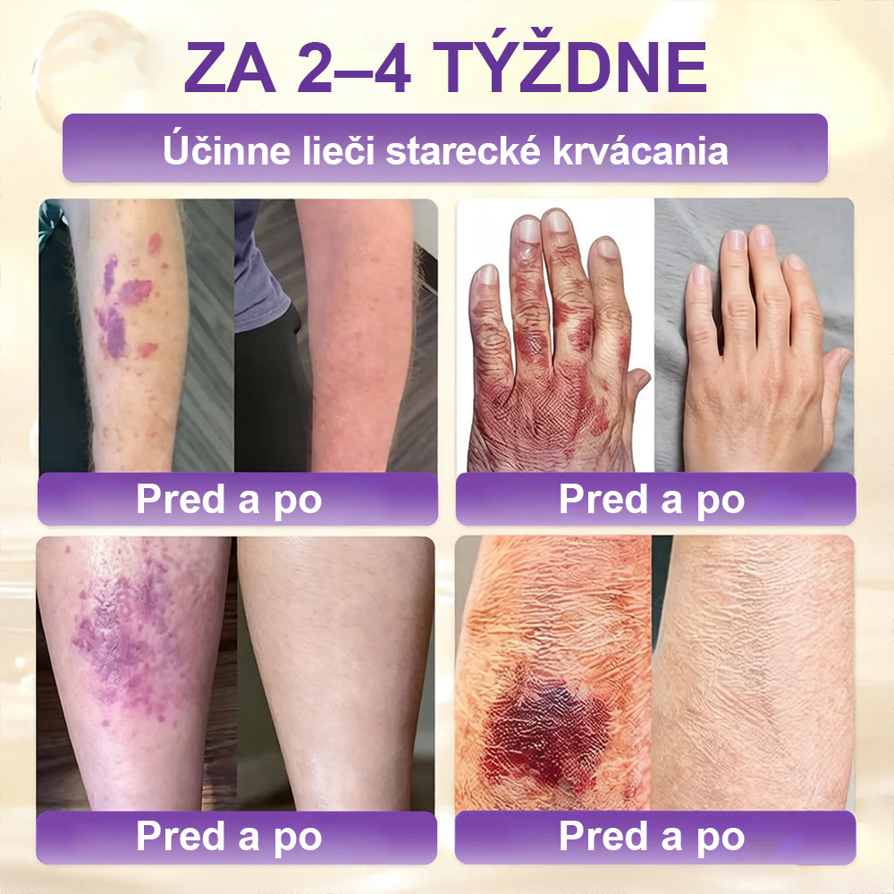 Laleia® Biotin 10 v 1 kožný regeneračný krém✨