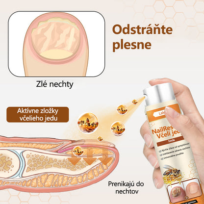 ⭐⭐Laleia® NailRescue sprej s včelím jedom