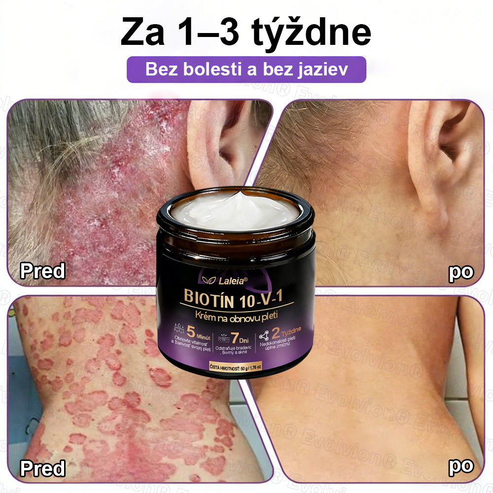 Laleia® Biotin 10 v 1 kožný regeneračný krém✨