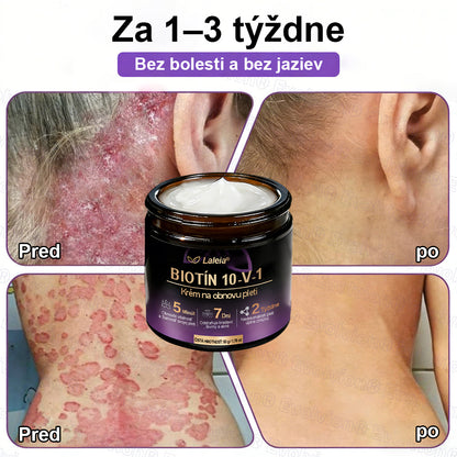 Laleia® Biotin 10 v 1 kožný regeneračný krém✨