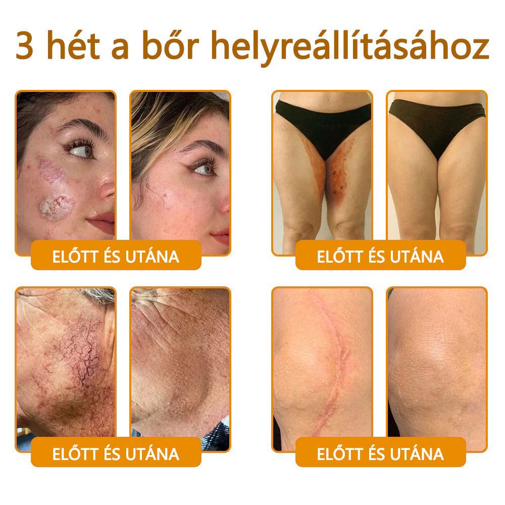 🍯🍯CleraNaure® Méhméreg Bőrregeneráló Krém🍯