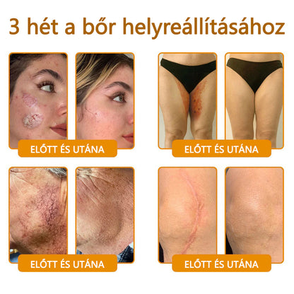 🍯🍯CleraNaure® Méhméreg Bőrregeneráló Krém🍯