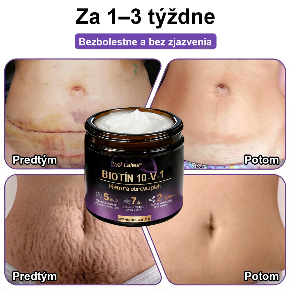Laleia® Biotin 10 v 1 kožný regeneračný krém✨
