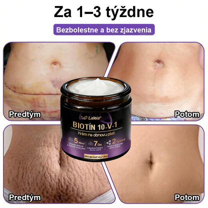 Laleia® Biotin 10 v 1 kožný regeneračný krém✨