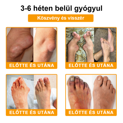 Buzora® Botulinum Toxin és Méhméreg Fájdalomcsillapító Csontgyógyító Krém🌿
