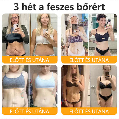 🍯🍯CleraNaure® Méhméreg Bőrregeneráló Krém🍯