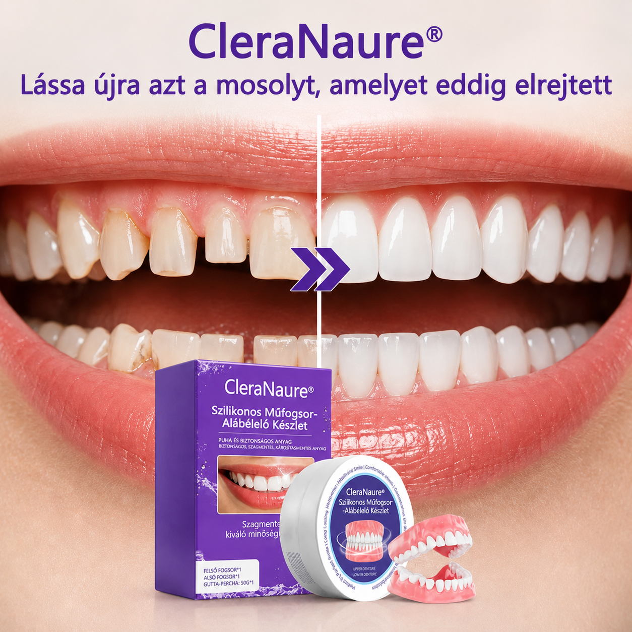 ⭐CleraNaure® – Ne takarja többé a száját nevetés közben! Magabiztosabb mosoly akár 3 perc alatt, fogorvos és hosszú várakozás nélkül.